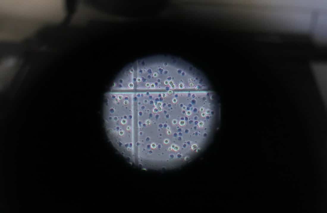 Coronavirus: vaccino Imperial College, notizie confortnati del test su uomo